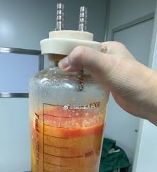 上杭水动力吸脂手术要做多久？